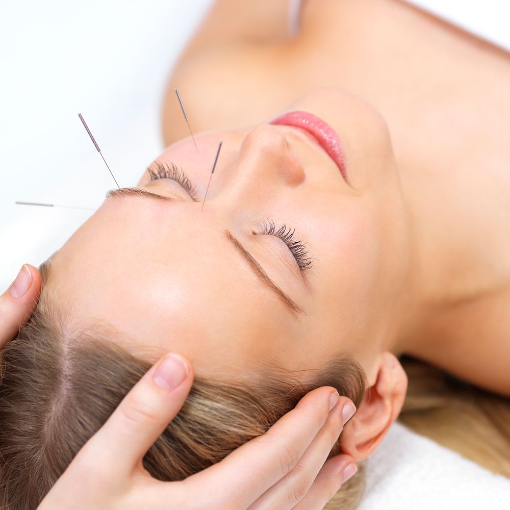 Can Acupuncture Really Reduce Wrinkles? If So, How?